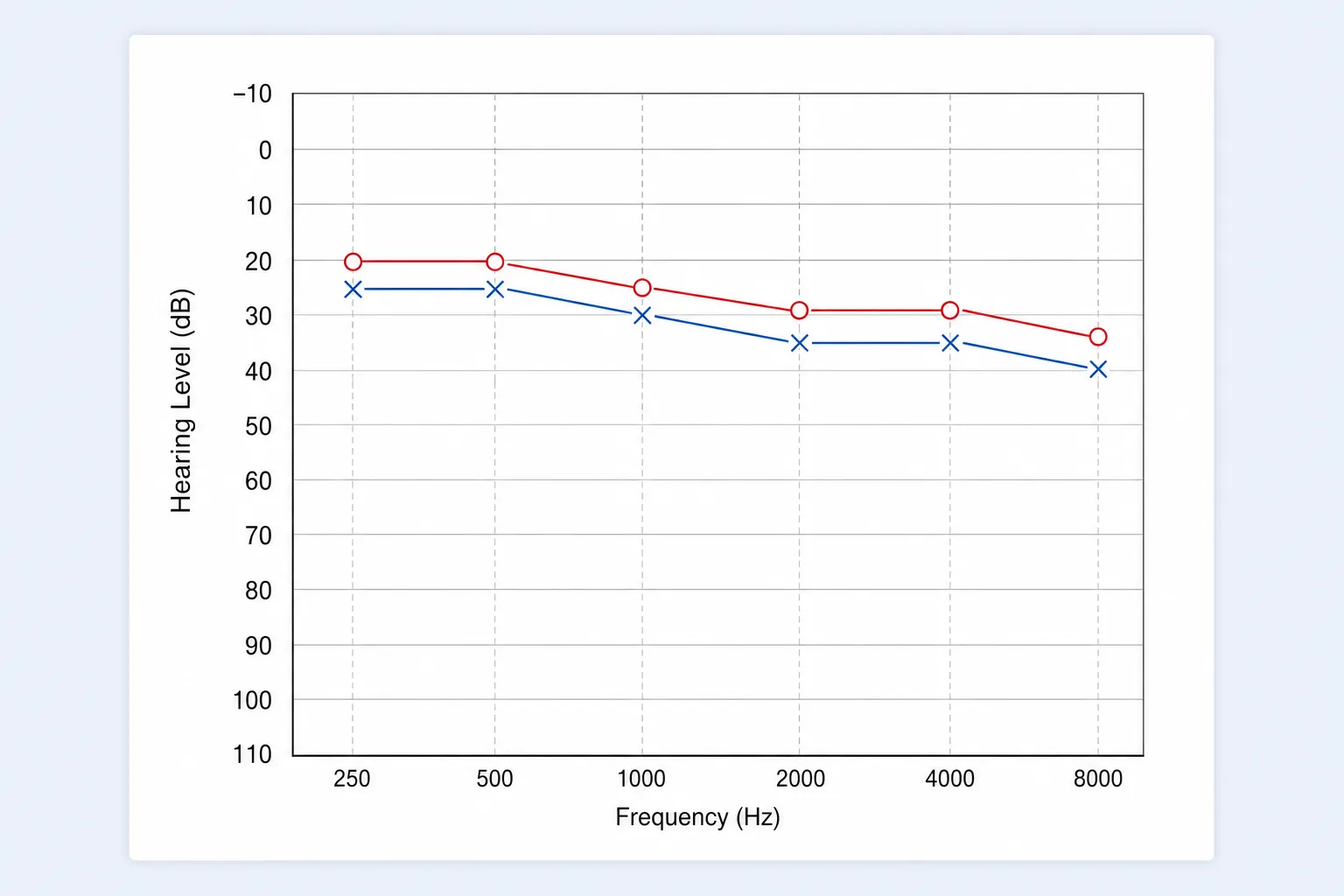 The audiogram — the test result