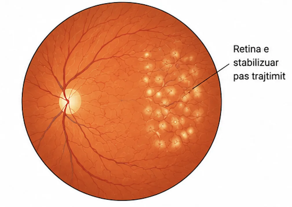 After laser treatment